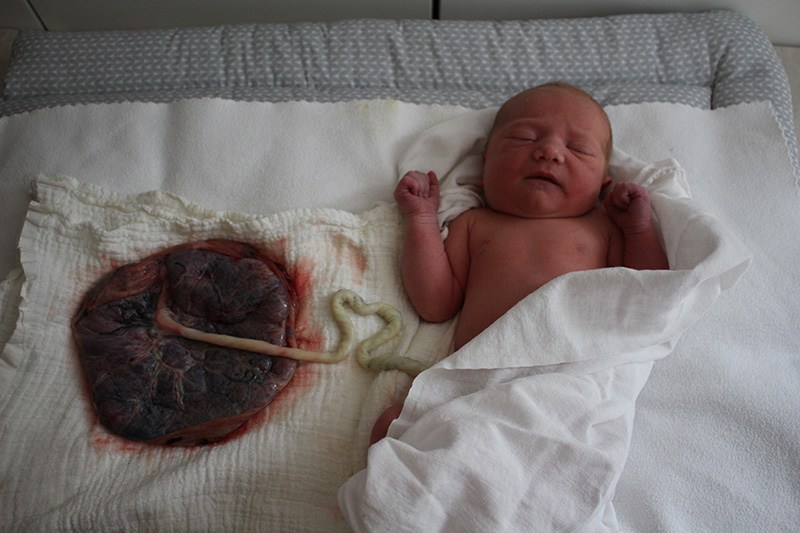 Ein neugeborenes Baby mit der Plazenta daneben. Wenige Minuten nach der Geburt